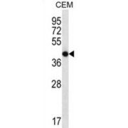 Olfactory Receptor 7G2 (OR7G2) Antibody