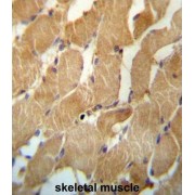 NADH Ubiquinone Oxidoreductase Complex Assembly Factor 2 (NDUFAF2) Antibody