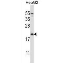 NADH Ubiquinone Oxidoreductase Complex Assembly Factor 2 (NDUFAF2) Antibody