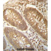 Probable Phosphoglycerate Mutase 4 (PGAM4) Antibody