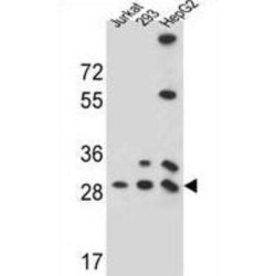 Probable Phosphoglycerate Mutase 4 (PGAM4) Antibody