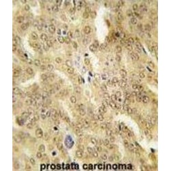 Heat Shock Protein 40 (HSP40) Antibody