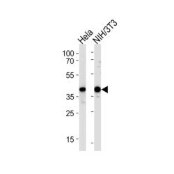 Heat Shock Protein 40 (HSP40) Antibody