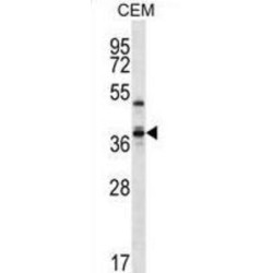 WD Repeat-Containing Protein 25 (WDR25) Antibody