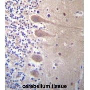 Zinc Finger Protein 764 (ZNF764) Antibody