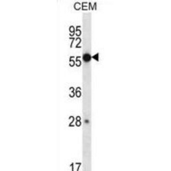 Zinc Finger Protein 764 (ZNF764) Antibody