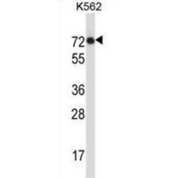 Interleukin 1 Receptor Like Protein 2 (IL1RL2) Antibody