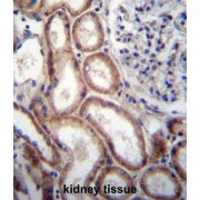 Slit Homolog 1 (SLIT1) Antibody