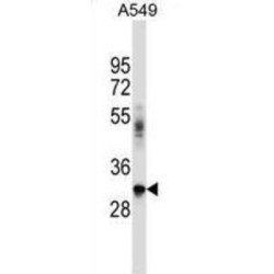 BCL2 Interacting Protein 2 (BNIP2) Antibody