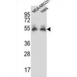 Prolylcarboxypeptidase (PRCP) Antibody