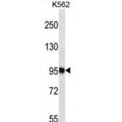 Tetratricopeptide Repeat Protein 15 (TTC15) Antibody