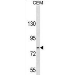 Transforming Growth Factor-Beta Receptor-Associated Protein 1 (TGFBRAP1) Antibody