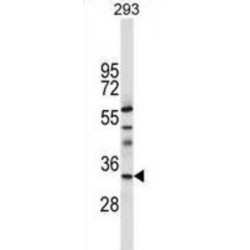 TATA-Box Binding Protein Associated Factor 8 (TAF8) Antibody