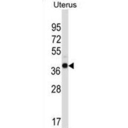 WD Repeat-Containing Protein 89 (WDR89) Antibody