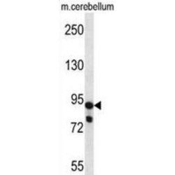 Ubiquitin Carboxyl-Terminal Hydrolase 45 (USP45) Antibody