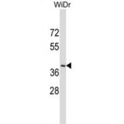 Dual Oxidase Maturation Factor 2 (DUOXA2) Antibody