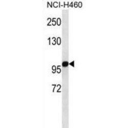 Oxoglutarate Dehydrogenase (OGDH) Antibody