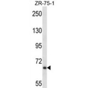 Junctophilin 2 (JPH2) Antibody