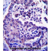 ADP-Ribosylation Factor-Like Protein 8A (ARL8A) Antibody