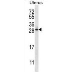 ADP-Ribosylation Factor-Like Protein 8A (ARL8A) Antibody