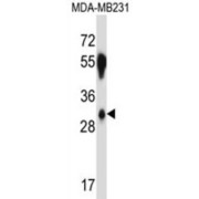 Splicing Factor, Arginine/serine-Rich 2B (SFRS2B) Antibody