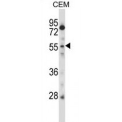 Cysteine/serine-Rich Nuclear Protein 2 (CSRNP2) Antibody