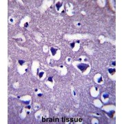 Coiled-Coil Domain-Containing Protein 117 (CCDC117) Antibody