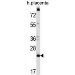 Coiled-Coil Domain-Containing Protein 117 (CCDC117) Antibody