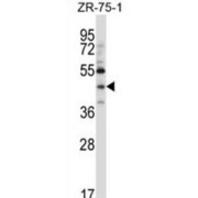 Neurogenic Differentiation 6 (NEUROD6) Antibody