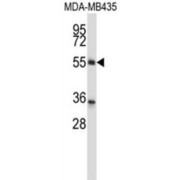 Zinc Finger Protein 222 (ZNF222) Antibody