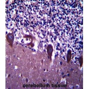 Transducin-Like Enhancer Protein 6 (TLE6) Antibody