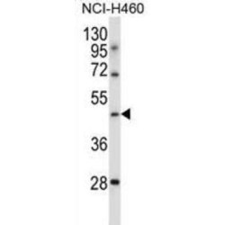 Transducin-Like Enhancer Protein 6 (TLE6) Antibody