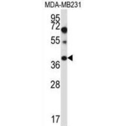 Protein Tyrosine Phosphatase Like Protein A (PTPLA) Antibody