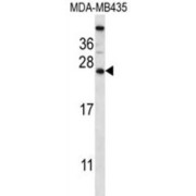 Calcium Binding Protein 5 (CABP5) Antibody
