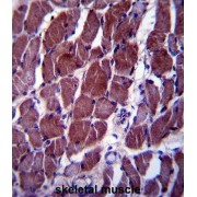 FLT3-Interacting Zinc Finger 1 (FIZ1) Antibody