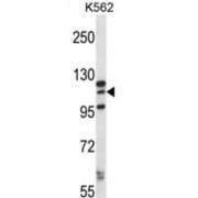 MORC Family CW-Type Zinc Finger 1 (MORC1) Antibody