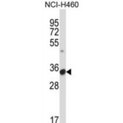 Fc Fragment of IgG Low Affinity IIIa Receptor (FCGR3A) Antibody