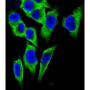 Lactate Dehydrogenase A (LDHA) Antibody