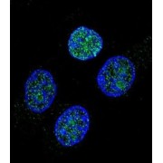 Vitamin K-Dependent Protein C (PROC) Antibody