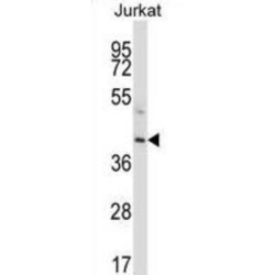 Vitamin K-Dependent Protein C (PROC) Antibody