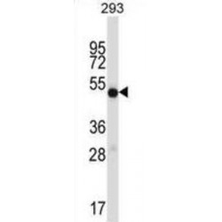 Inosine-5'-Monophosphate Dehydrogenase 1 (IMPDH1) Antibody