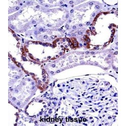 Mucolipin 1 (MCOLN1) Antibody