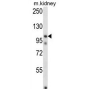 WB analysis of mouse kidney tissue lysates.