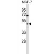 WD Repeat-Containing Protein 88 (WDR88) Antibody