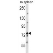 NUFIP2, FMR1 Interacting Protein 2 (NUFIP2) Antibody