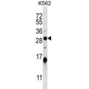 Stathmin 4 (STMN4) Antibody