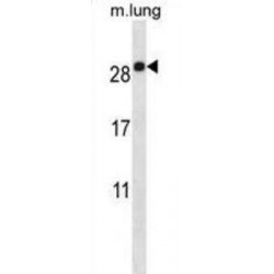 Epithelial Membrane Protein 2 (EMP2) Antibody