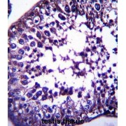 Testis-Specific Y-Encoded-Like Protein 5 (TSPYL5) Antibody