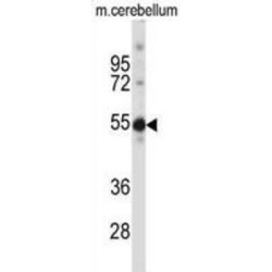 Testis-Specific Y-Encoded-Like Protein 5 (TSPYL5) Antibody