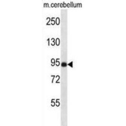 Protein FAN (NSMAF) Antibody